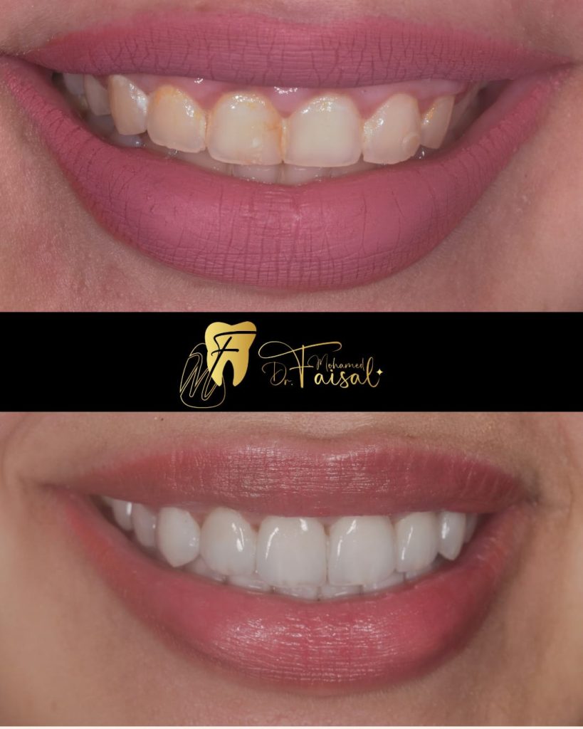 أفضل دكتور أسنان في القاهرة: تجربة د. محمد فيصل في الرعاية الشاملة